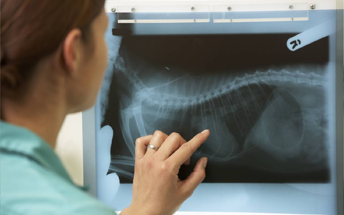 A person pointing at an x-ray